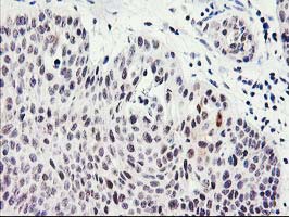m09602 anti serpinb13 mouse monoclonal antibody clone id oti2b6 ihc testing 2