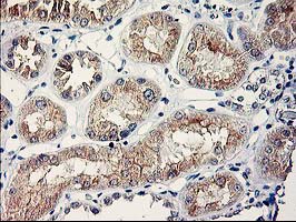 m09602 anti serpinb13 mouse monoclonal antibody clone id oti2b6 ihc testing 4