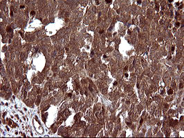 m09616 1 anti uprt mouse monoclonal antibody clone id oti2d1 ihc testing 11