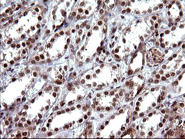 m09616 1 anti uprt mouse monoclonal antibody clone id oti2d1 ihc testing 12