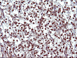 m09616 1 anti uprt mouse monoclonal antibody clone id oti2d1 ihc testing 13