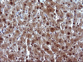 m09616 1 anti uprt mouse monoclonal antibody clone id oti2d1 ihc testing 14