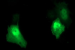 m09616 anti uprt mouse monoclonal antibody clone id oti3a3 if testing 12