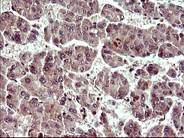 m09616 anti uprt mouse monoclonal antibody clone id oti3a3 ihc testing 11