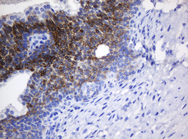 m09658 1 anti nanp mouse monoclonal antibody clone id oti4f5 ihc testing 3