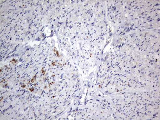 m09664 anti igsf11 mouse monoclonal antibody clone id oti2h1 ihc testing 10