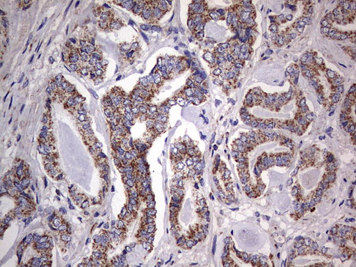 m09664 anti igsf11 mouse monoclonal antibody clone id oti2h1 ihc testing 11