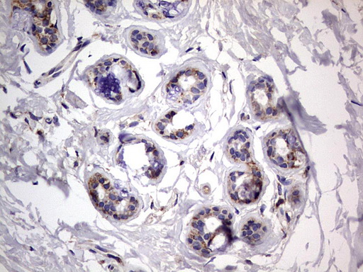 m09664 anti igsf11 mouse monoclonal antibody clone id oti2h1 ihc testing 12