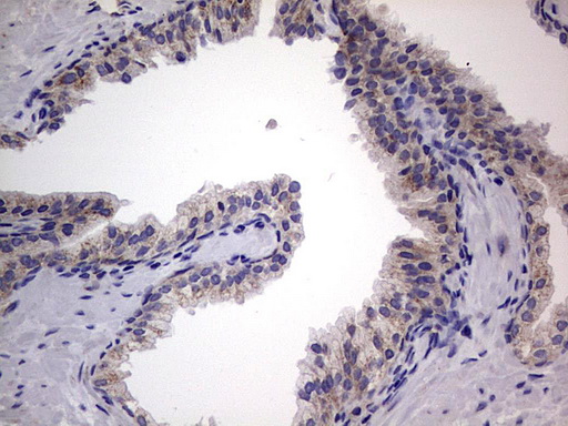 m09664 anti igsf11 mouse monoclonal antibody clone id oti2h1 ihc testing 13