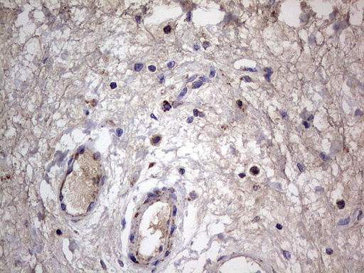 m09664 anti igsf11 mouse monoclonal antibody clone id oti2h1 ihc testing 14