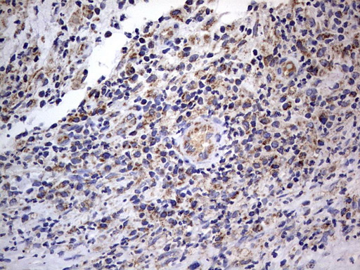 m09664 anti igsf11 mouse monoclonal antibody clone id oti2h1 ihc testing 15