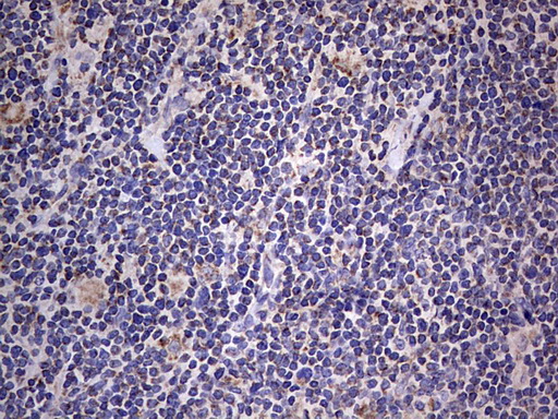 m09664 anti igsf11 mouse monoclonal antibody clone id oti2h1 ihc testing 16