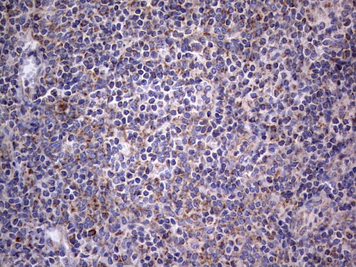 m09664 anti igsf11 mouse monoclonal antibody clone id oti2h1 ihc testing 17