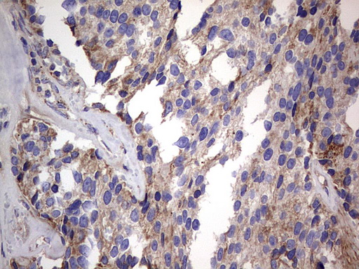 m09664 anti igsf11 mouse monoclonal antibody clone id oti2h1 ihc testing 18