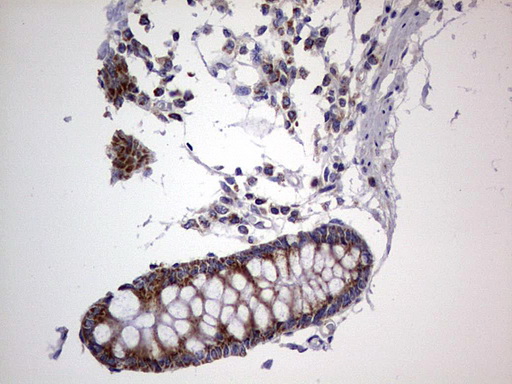 m09664 anti igsf11 mouse monoclonal antibody clone id oti2h1 ihc testing 19