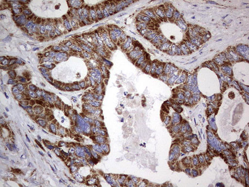 m09664 anti igsf11 mouse monoclonal antibody clone id oti2h1 ihc testing 20