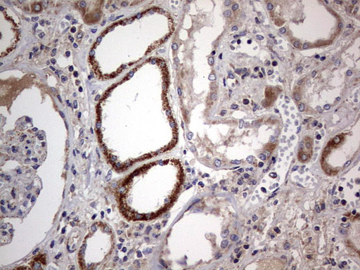 m09664 anti igsf11 mouse monoclonal antibody clone id oti2h1 ihc testing 21