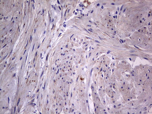 m09664 anti igsf11 mouse monoclonal antibody clone id oti2h1 ihc testing 22