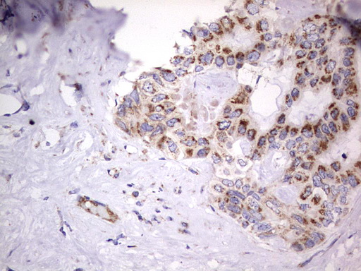 m09664 anti igsf11 mouse monoclonal antibody clone id oti2h1 ihc testing 24