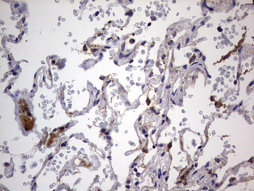 m09664 anti igsf11 mouse monoclonal antibody clone id oti2h1 ihc testing 25