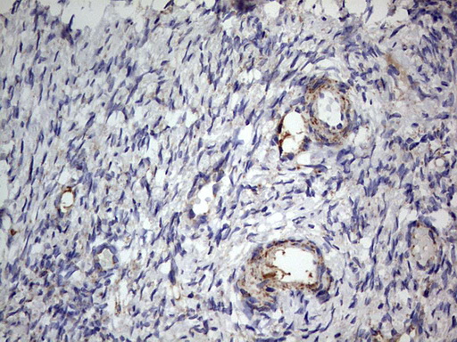 Immunohistochemical staining of paraffin-embedded Human Ovary tissue within the normal limits using anti-IGSF11 mouse monoclonal antibody