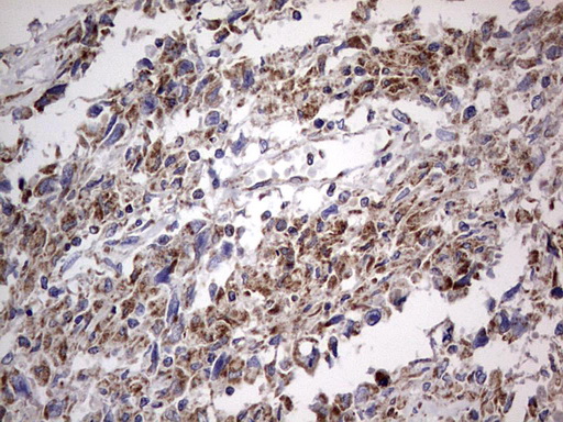 m09664 anti igsf11 mouse monoclonal antibody clone id oti2h1 ihc testing 4