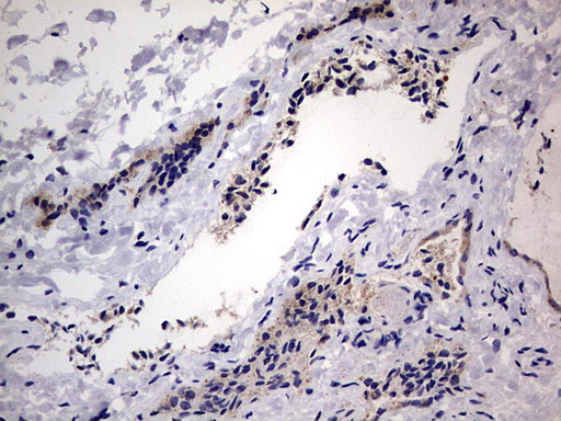 m09664 anti igsf11 mouse monoclonal antibody clone id oti2h1 ihc testing 7