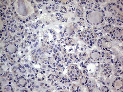 m09664 anti igsf11 mouse monoclonal antibody clone id oti2h1 ihc testing 8