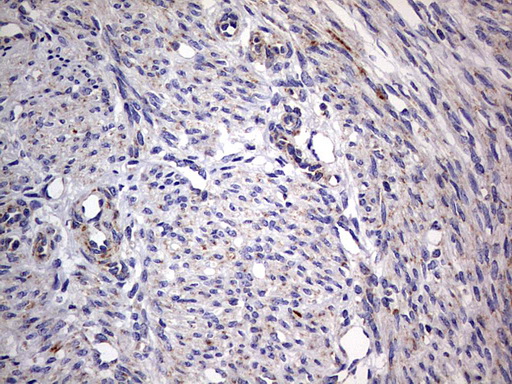 m09664 anti igsf11 mouse monoclonal antibody clone id oti2h1 ihc testing 9