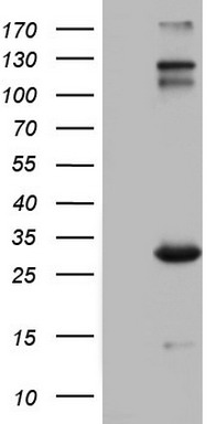 HEK293T cells were transfected with the pCMV6-ENTRY control (Left lane) or pCMV6-ENTRY IGSF11 (Right lane) cDNA for 48 hrs and lysed