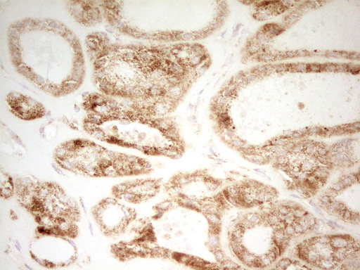 m09708 anti mrrf mouse monoclonal antibody clone id oti1d5 ihc testing 4