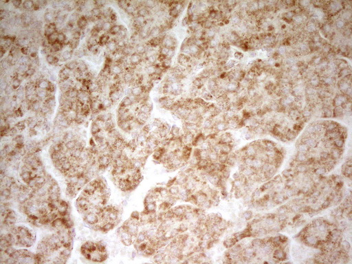 m09708 anti mrrf mouse monoclonal antibody clone id oti1d5 ihc testing 9