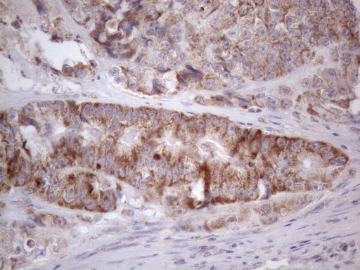 m09711 anti ror beta rorb mouse monoclonal antibody clone id oti1g1 ihc testing 10
