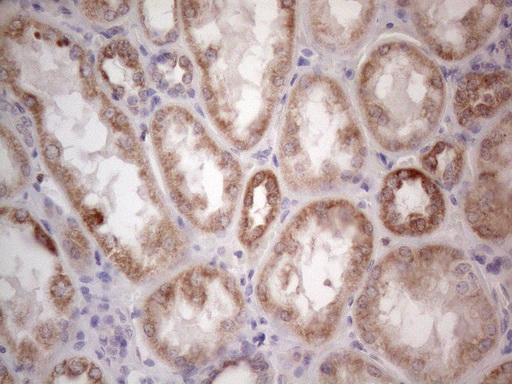 m09711 anti ror beta rorb mouse monoclonal antibody clone id oti1g1 ihc testing 11