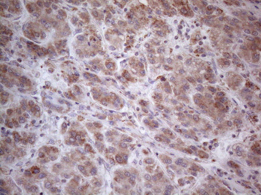 m09711 anti ror beta rorb mouse monoclonal antibody clone id oti1g1 ihc testing 13