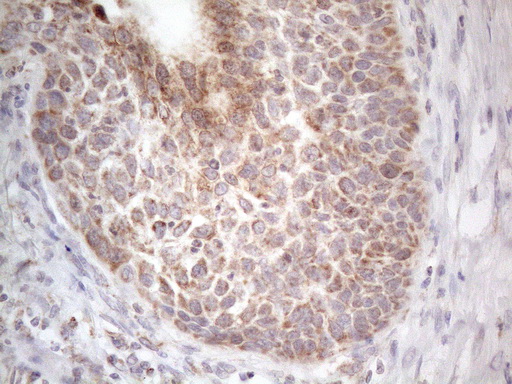m09711 anti ror beta rorb mouse monoclonal antibody clone id oti1g1 ihc testing 2