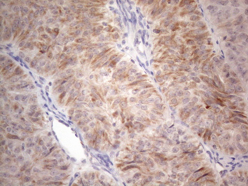 m09711 anti ror beta rorb mouse monoclonal antibody clone id oti1g1 ihc testing 3
