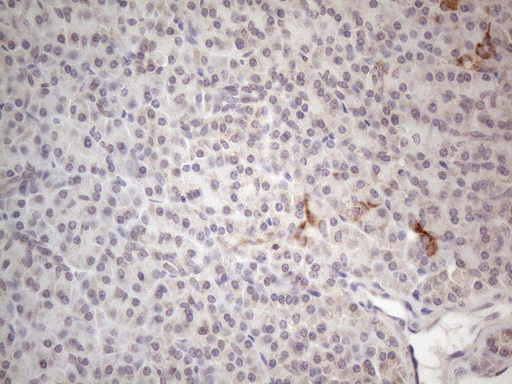 m09711 anti ror beta rorb mouse monoclonal antibody clone id oti1g1 ihc testing 4