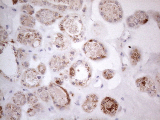 m09711 anti ror beta rorb mouse monoclonal antibody clone id oti1g1 ihc testing 5