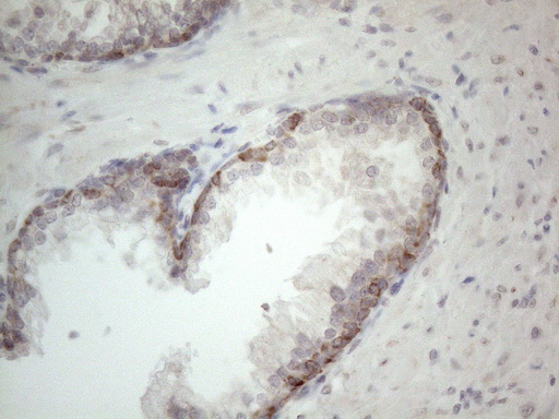 m09711 anti ror beta rorb mouse monoclonal antibody clone id oti1g1 ihc testing 6