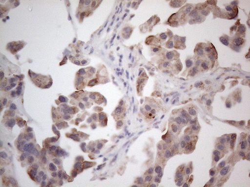 m09711 anti ror beta rorb mouse monoclonal antibody clone id oti1g1 ihc testing 8