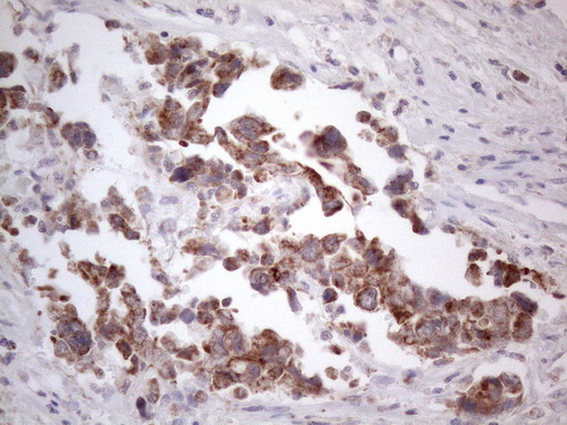m09711 anti ror beta rorb mouse monoclonal antibody clone id oti1g1 ihc testing 9
