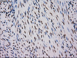 Immunohistochemical staining of paraffin-embedded Human endometrium tissue within the normal limits using anti-MRI1 mouse monoclonal antibody