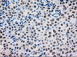 m09725 1 anti mri1 mouse monoclonal antibody clone id oti9h7 ihc testing 4