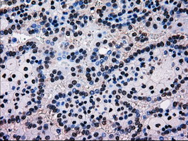 m09725 1 anti mri1 mouse monoclonal antibody clone id oti9h7 ihc testing 5
