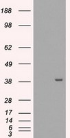 HEK293T cells were transfected with the pCMV6-ENTRY control (Left lane) or pCMV6-ENTRY MRI1 (Right lane) cDNA for 48 hrs and lysed