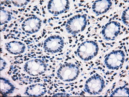 m09725 anti mri1 mouse monoclonal antibody clone id oti6g9 ihc testing 7