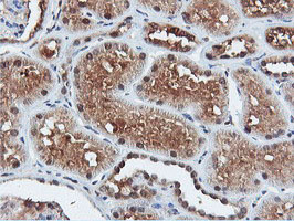 m09732 anti dusp23 mouse monoclonal antibody clone id oti3c10 ihc testing 11