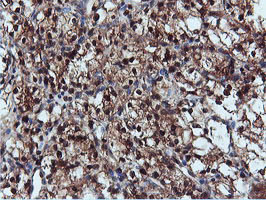 m09732 anti dusp23 mouse monoclonal antibody clone id oti3c10 ihc testing 12