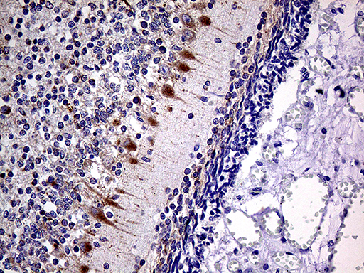Immunohistochemical staining of paraffin-embedded Human embryonic cerebellum within the normal limits using anti-SLC22A17 mouse monoclonal antibody. (Heat-induced epitope retrieval by 1mM EDTA in 10mM Tris buffer (pH8.5) at 120°C for 3min